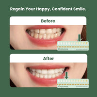 Advanced Teeth Whitening Strips