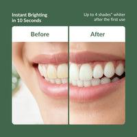 Advanced Teeth Whitening Strips